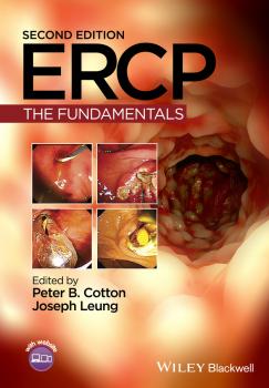ERCP, Enhanced Edition. The Fundamentals